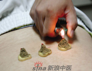灸法的種類  你知道多少？